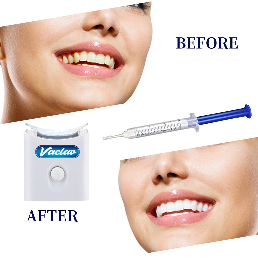 Jeringa de Gel blanqueador de  - Teeth Whitening Kit At Home reseña y precio