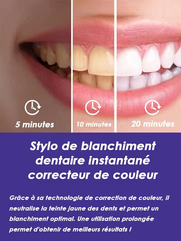 Set de 2 Bolígrafos Blanqueado - Teeth Whitening Gel Pen reseña y precio