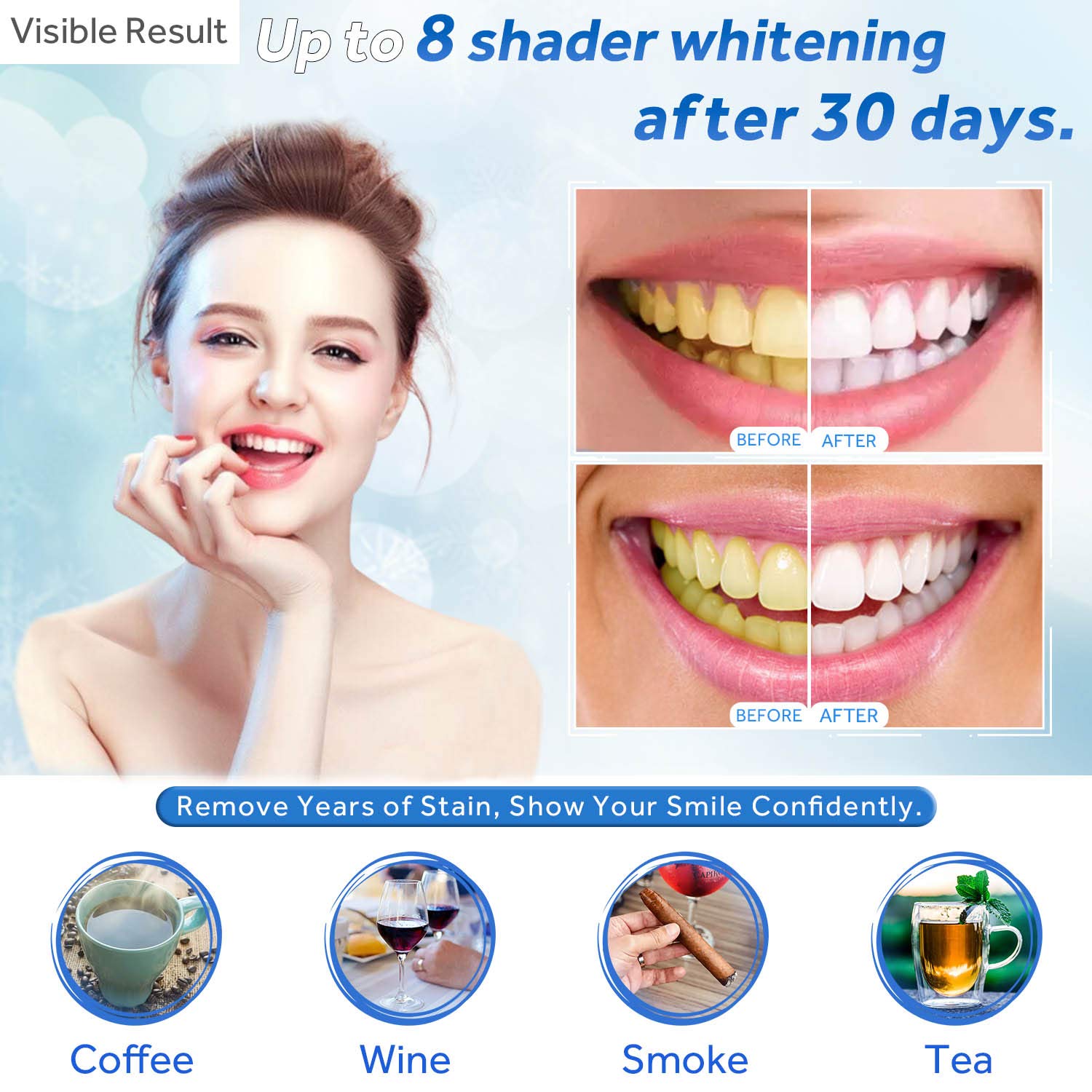 Jeringa de repuesto de Gel par - Teeth Whitening Q&M reseña y precio