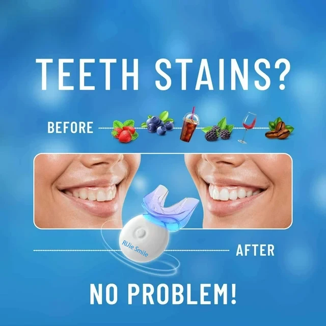 Kit de Blanqueamiento Dental I - Teeth Whitening Kit At Home reseña y precio